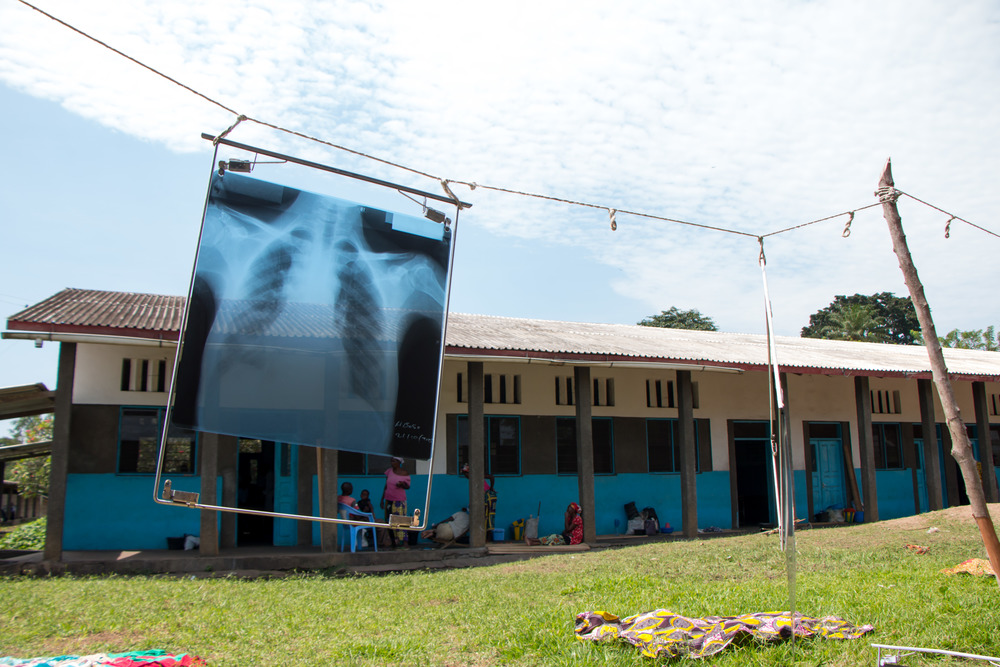An X-ray on the line with the Vanga Evangelical Hospital in the background. Photo by Mark & Kelly Hewes.